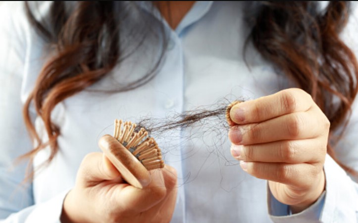 Causes of Severe Hair Loss